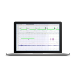 SOMNOmedics DOMINO AI - Görsel 3