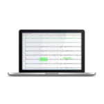 SOMNOmedics DOMINO AI - Görsel 6